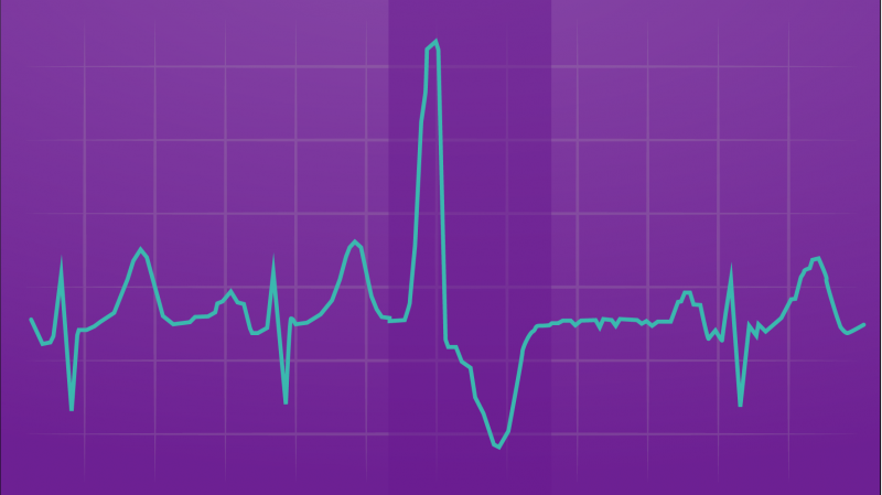 UMH_LL-PVCs-20161010-01-01.png